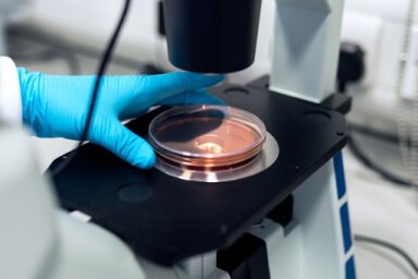Gynaecology & Women’s Health Services diagnostic lab case gallery 4