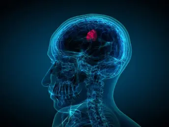 brain tumor evaluation